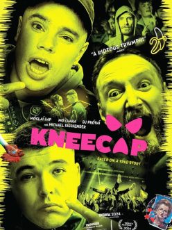 Kneecap